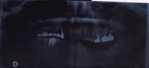 Madamef yo7yze - Eugenol