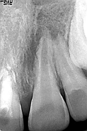 Mai 2007  21  lei4bk - Eugenol