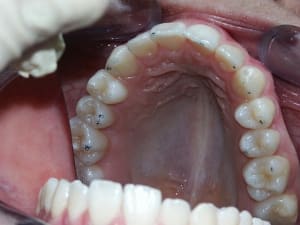 Max2 zbfhfo - Eugenol