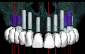 Mci2 djn9if - Eugenol