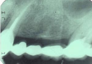 Mfretrosup1 trhobp - Eugenol