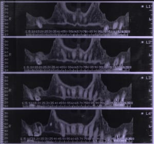 Mfscan5 ihe729 - Eugenol