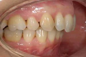 Moi1 jh2qxp - Eugenol