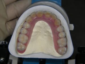 Montage cire de6cuf - Eugenol