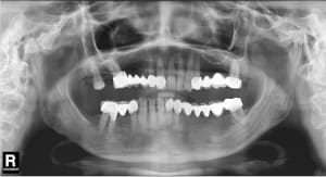 Necroses333333 mcm4ut - Eugenol