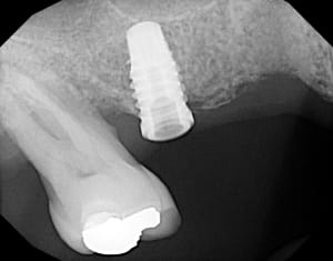 Nyexd68av3c7i1pkjwsepfxemefd - Eugenol