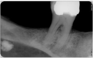 Ominhhtwpdiakjehxfji - Eugenol