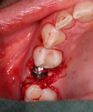 Onferme apfjh6 - Eugenol