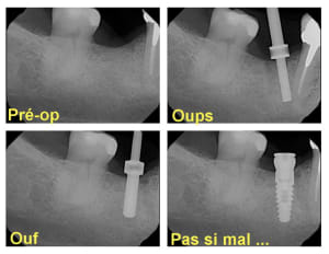 Oups pov3ku - Eugenol