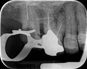 P23omlufrdnfnbluv04wqyptp0vv - Eugenol