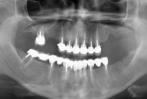 Pano 07112015 hvxbbe - Eugenol