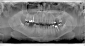 Pano 14 jzkgzc - Eugenol