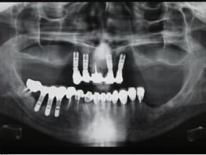 Pano 1 cuca1a - Eugenol