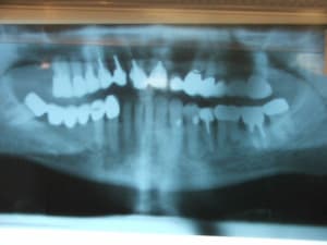 Pano gsl7mb - Eugenol