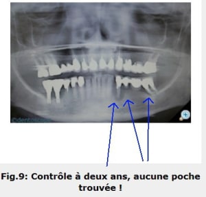 Paro 1 vfd8me - Eugenol