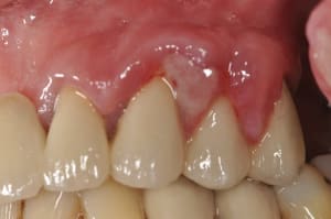 Parodo 3 o5crwb - Eugenol