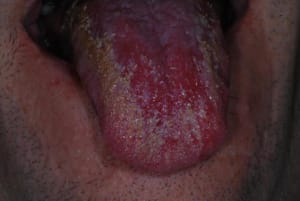 Patho1 pm43te - Eugenol