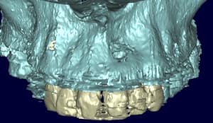 Patricia 3d kyste3 vo2arb - Eugenol