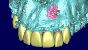 Patricia 3d ma17lj - Eugenol