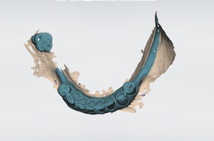 Peng 1 dsodl8 - Eugenol