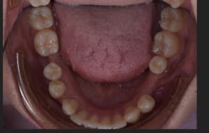 Pho rzo2gu - Eugenol