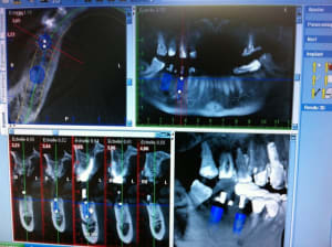 Photo1 yrnepg - Eugenol