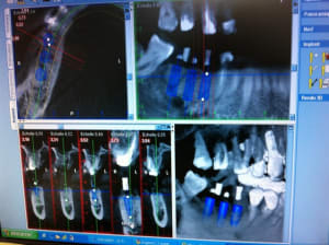 Photo2 i8kvue - Eugenol