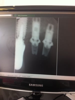 Photo 2 igdnpp - Eugenol