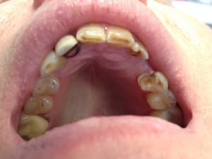 Photo 2 mf4c3b - Eugenol