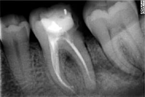 Photo 3 kujmwj - Eugenol