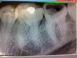 Photo  002  x9iy9w - Eugenol