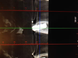Photo 4 bxnzj5 - Eugenol