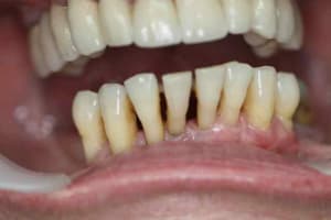 Photo de controle ws6zzb - Eugenol