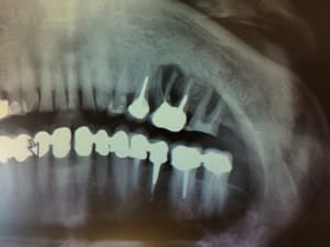 Photo x9zzxr - Eugenol