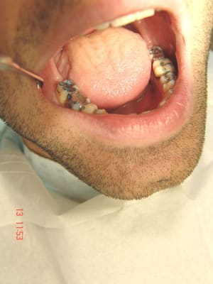 Points wgrlda - Eugenol