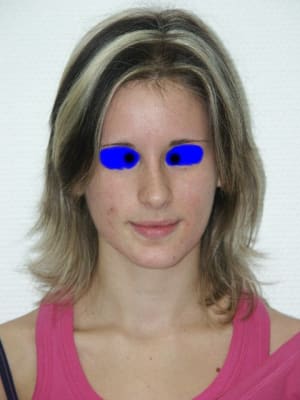 Portraitdeface qcnh4h - Eugenol