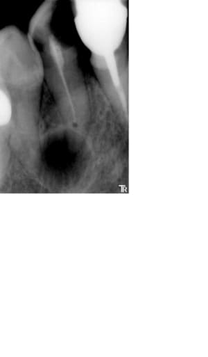 Pre op j4qyrh - Eugenol