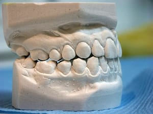 Propulsiond vrvtv4 - Eugenol
