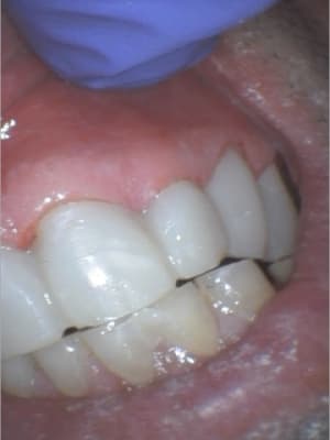 Prov6 derfxs - Eugenol