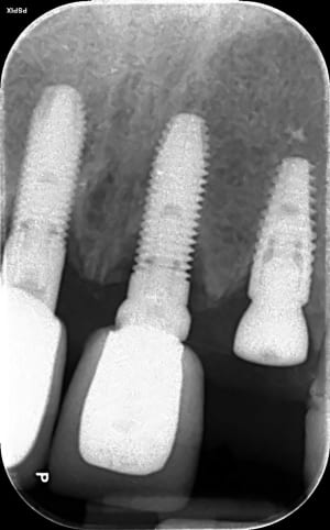 Qc1z9rh5k9zx4wpn2d3oaw445465 - Eugenol