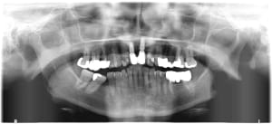 Quovjlurf5y3fscohkbl - Eugenol