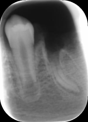 Rad1 qw9uez - Eugenol