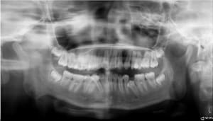 Rdvxtj6zgu3u0giwnff3 - Eugenol