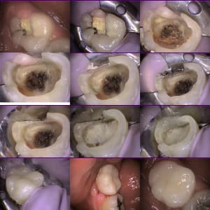 Recap 200 ko wtlj4v - Eugenol