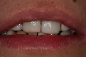 Repos uxh6x2 - Eugenol