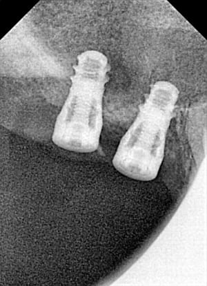 Ric skecuu - Eugenol