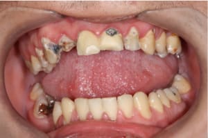 Rld hqgi8o - Eugenol