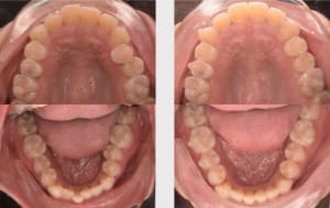 Rw4m4f5b8bwvuo6sif46c08vl797 - Eugenol