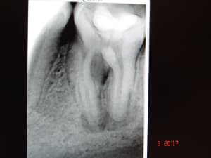 Rx1 omp38z - Eugenol