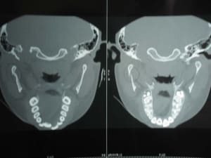 Scan2 shnjyv - Eugenol
